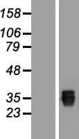 SSMEM1 / C7orf45 Protein (Over-Expression Lysate Myc-DDK (Flag))