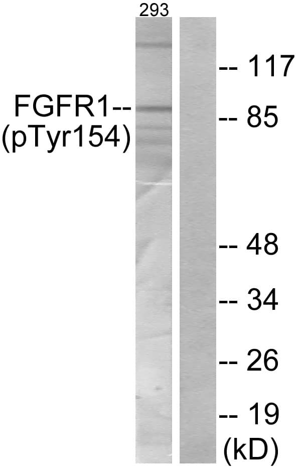 FGFR1 / FGF Receptor 1 Antibody (phospho-Tyr154)