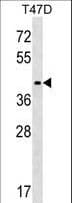 Polyclonal Rabbit anti-Human MMADHC / C2orf25 Antibody (aa226-253, WB)