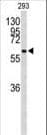 CDC73 / Parafibromin Antibody (aa132-161)