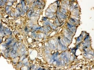 TGM2 / Transglutaminase 2 Antibody