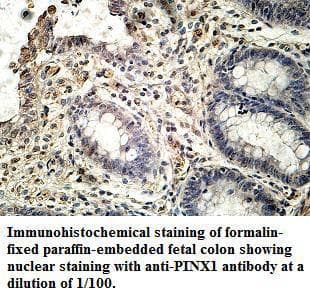 Polyclonal Rabbit anti-Human PINX1 Antibody (aa21-281, IHC, WB)