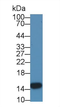 I-FABP / FABP2 Antibody (aa4-129)