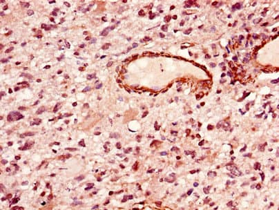 LIPE / HSL Antibody