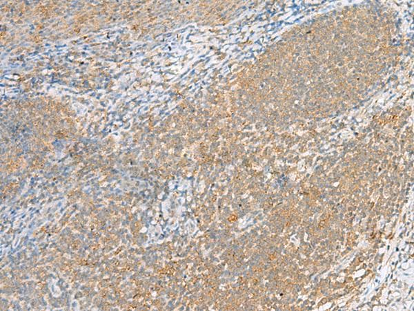 Polyclonal Rabbit anti-Human FOLR1 / Folate Receptor Alpha Antibody (IHC)