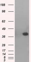 MAPK11 / SAPK2 / p38 Beta Antibody (clone OTI1C2)