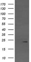 VHL / Von Hippel Lindau Antibody (clone OTI1E1)