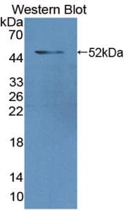 LMNA / Lamin A+C Antibody