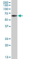 Monoclonal Mouse anti-Human CAT / Catalase Antibody (clone 2G6, WB)