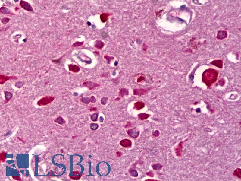 IHC-plus™ CCN5 Antibody (clone 1E11)
