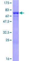 Human OAS1 Protein (Recombinant GST)