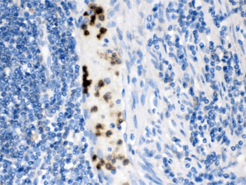 FABP3 / H-FABP Antibody (aa119-133)