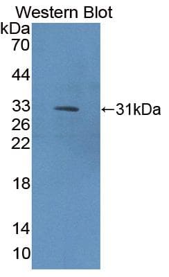 COL9A1 / Collagen IX Antibody (Biotin)