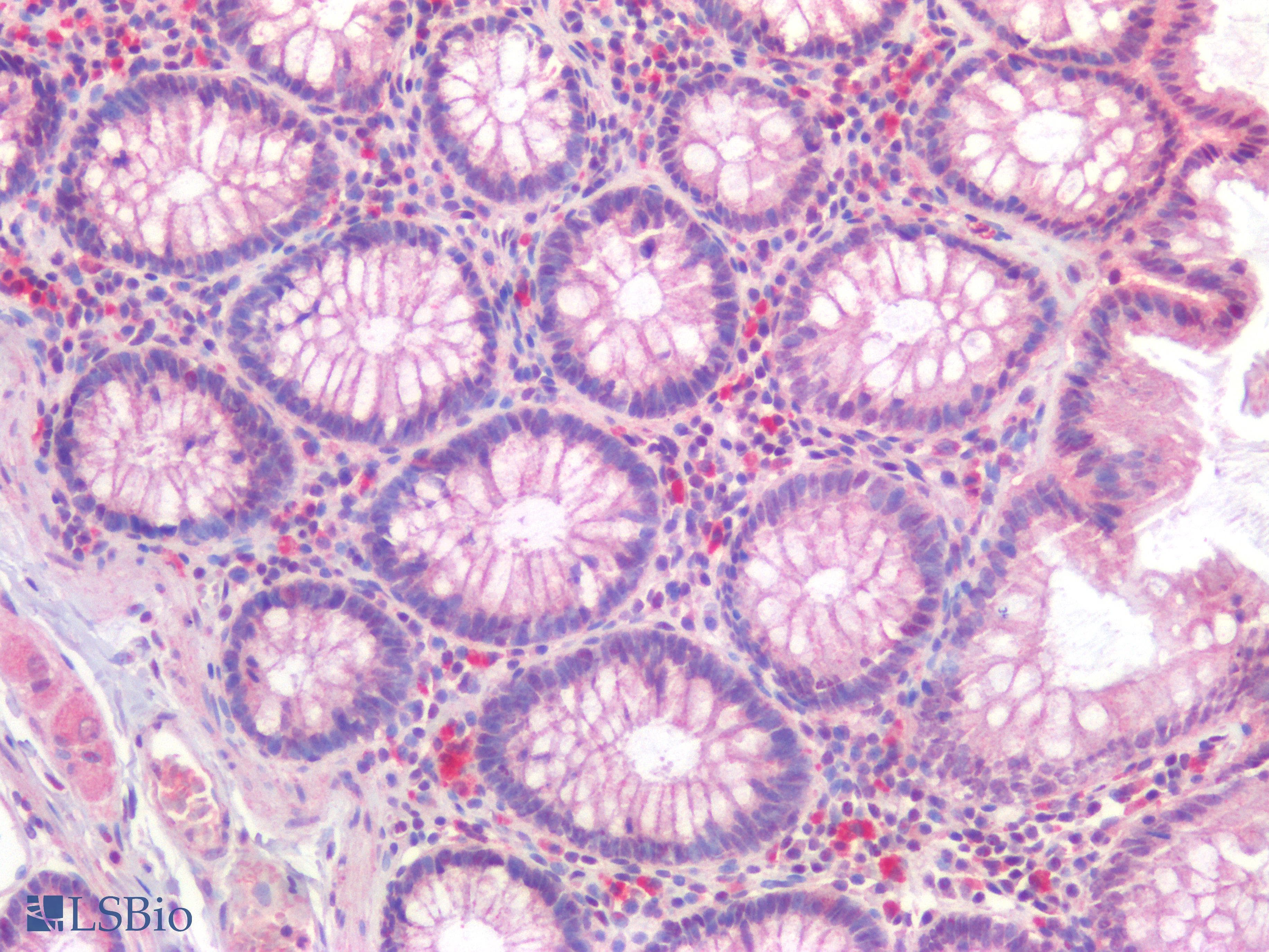 PathPlus™ Polyclonal Rabbit anti-Human Osteocalcin Antibody (IHC)
