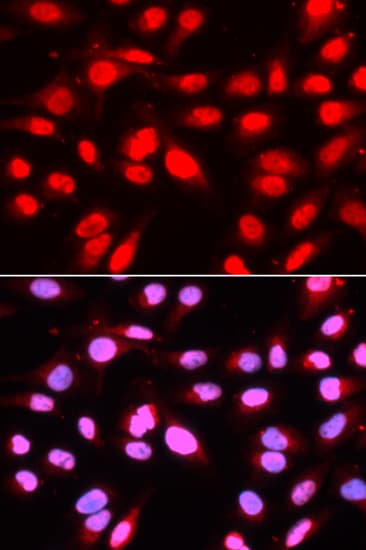 U2AF2 / U2AF65 Antibody