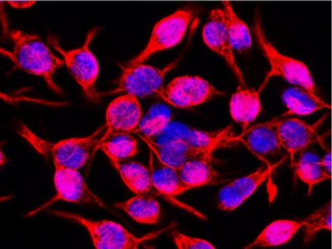 Vimentin Antibody (clone VI-10)