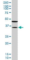 Monoclonal Mouse anti-Human SORD / Sorbitol Dehydrogenase Antibody (clone 4D3, IHC, WB)