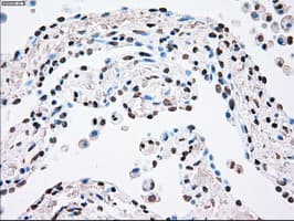 PLK1 / PLK-1 Antibody (clone OTI1D4)