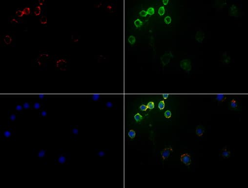CD5 Antibody (clone UMAB9, Carrier-free)