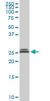 Monoclonal Mouse anti-Human PAFAH1B3 Antibody (clone 3G6, WB)