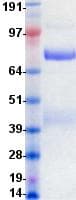 Human c-Met Protein (Recombinant DDK (Flag)-His, C-terminus)