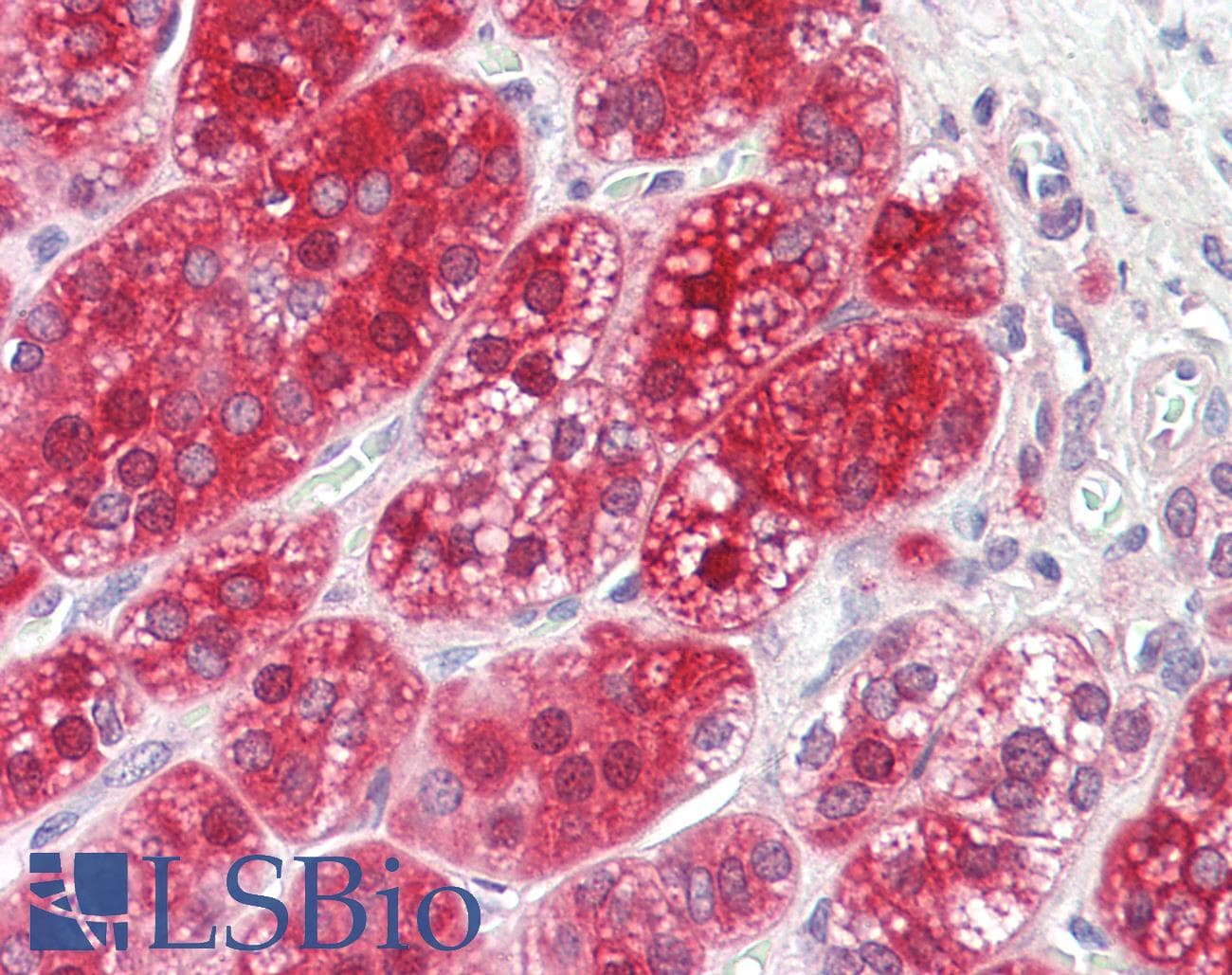 IHC-plus™ CD135 / FLT3 Antibody