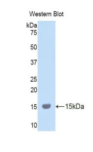LOXL2 Antibody (aa323-427)