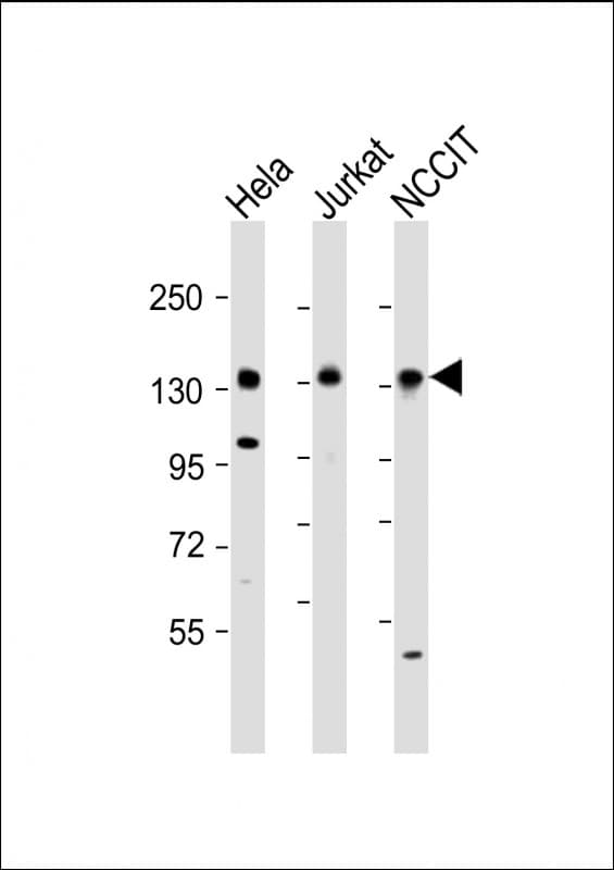 PHC1 / EDR1 Antibody (aa308-342)
