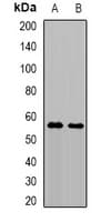 Polyclonal Rabbit anti-Human TRMT61B Antibody (WB)