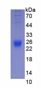 Mouse IL2 Protein (Recombinant His, N-Terminal)