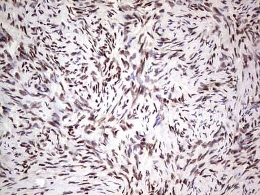 SAE1 Antibody (clone OTI3C3)