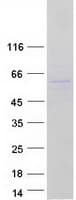 Human TC2N Protein (Recombinant Myc-DDK (Flag))