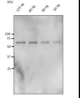 IHC-plus™ Polyclonal Goat anti-Human CAT / Catalase Antibody (IHC, WB)