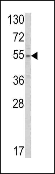 IHC-plus™ Polyclonal Rabbit anti-Human SLC38A3 / SNAT3 Antibody (aa442-468, IHC, WB)