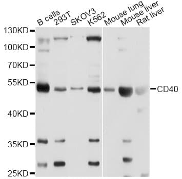Polyclonal Rabbit anti-Human CD40 Antibody (IHC, WB)