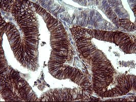PDGFRB / PDGFR Beta Antibody (clone OTI1E8, Carrier-free)