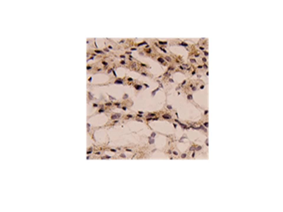 Monoclonal Mouse anti-Human IL-1B / IL-1 Beta Antibody (aa118-269, IHC, WB)