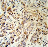 KRT13 / CK13 / Cytokeratin 13 Antibody (aa106-138)