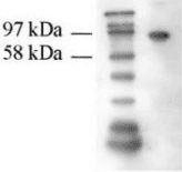 TGM2 / Transglutaminase 2 Antibody (clone 7D2)