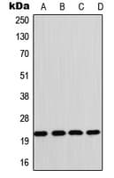 GP1BB / CD42c Antibody (Internal)