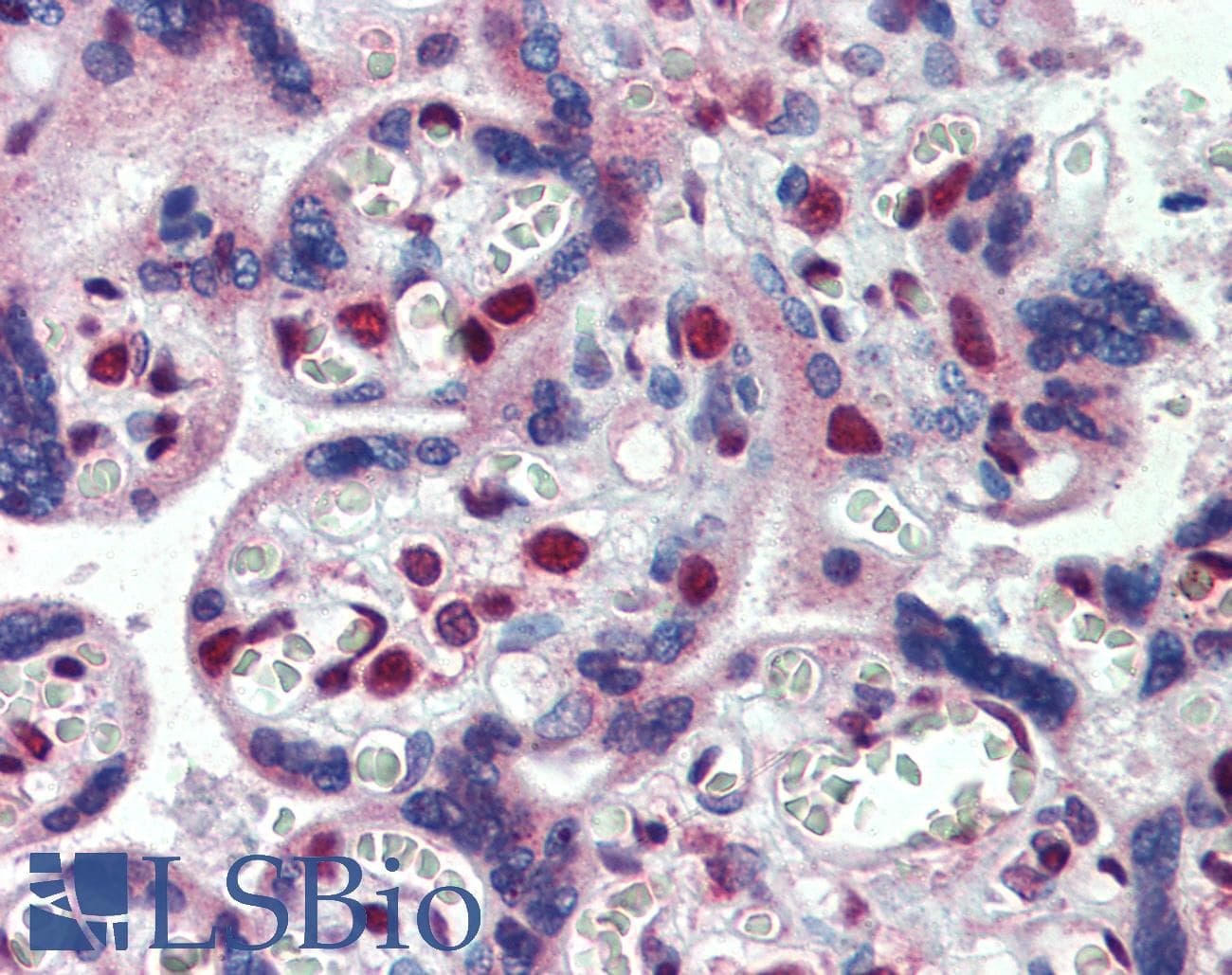 IHC-plus™ Polyclonal Goat anti-Human FMR1 / FMRP Antibody (aa116-130, IHC, WB)