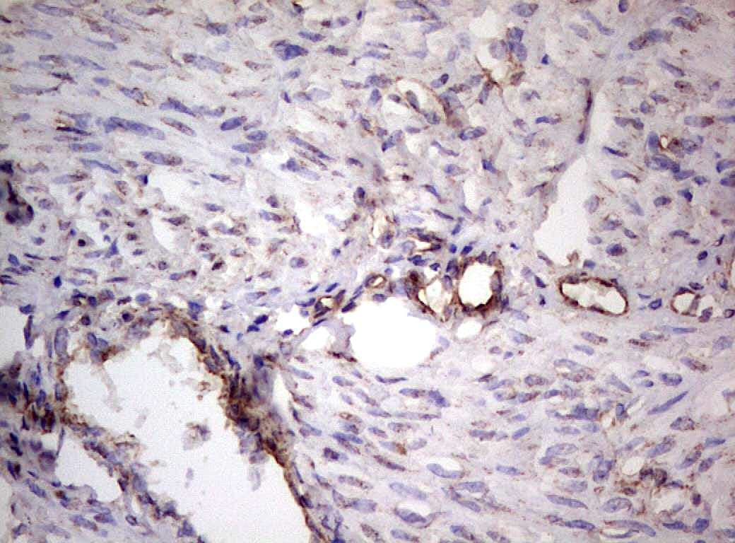 PROCR / EPCR Antibody (aa1-210, clone OTI9E11)