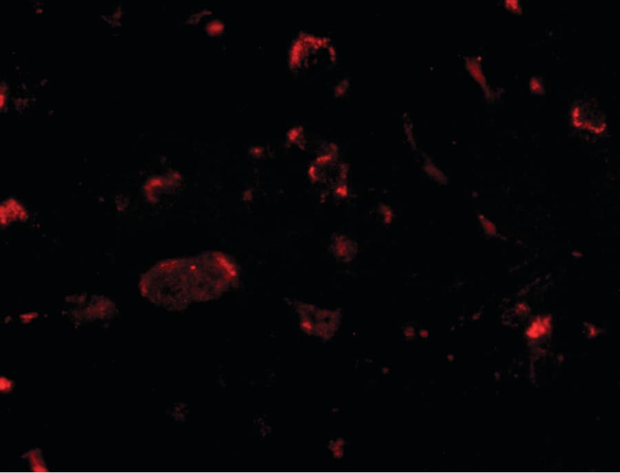 Polyclonal Rabbit anti-Human SLITRK2 Antibody (IHC, IF, WB)