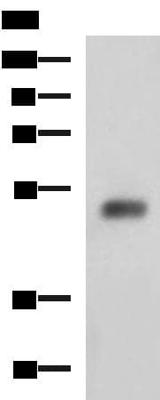 SLC30A6 Antibody