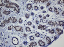 MGMT Antibody (clone OTI1B12)