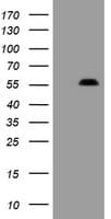 IHC-plus™ PHF7 Antibody (clone 1A11)