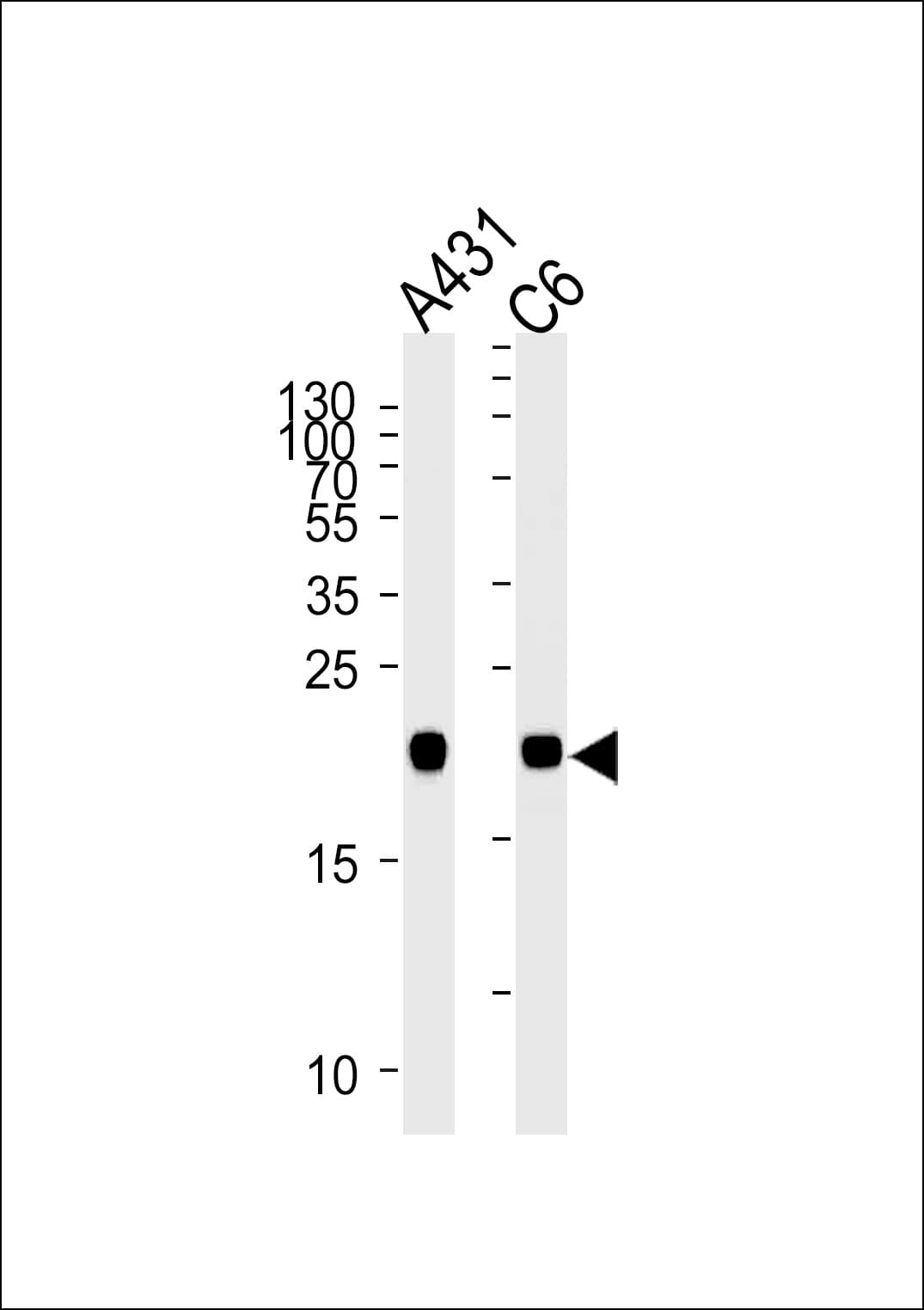 Monoclonal Mouse anti-Human NRAS / N-ras Antibody (clone 822CT17.5.1, aa70-101, WB)