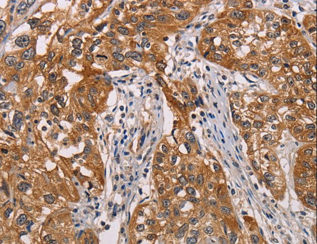 CRYAB / Alpha B Crystallin Antibody