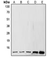 SUMO1 / SMT3 Antibody (N-Terminus)