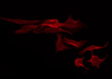 ABCC3 / MRP3 Antibody